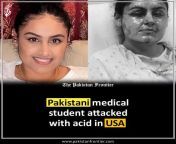 Pakistani medical student in New York Nafiah Fatima was attacked with acid. This is the 3rd attack on Pakistani national in America and US authorities and media are nowhere to be seen. from pakistani actresss
