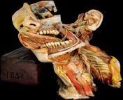 Dissection of the Head and neck (wax model) circa 1851 from 黑森州怎么找高雅的小姐）123薇信咨询网址▷em22 cc125黑森州怎么找小妹小姐多的地方 黑森州哪里有美丽的小姐） 1851