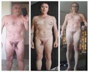 51years old can&#39;t say no surgery as put 3 candid photos of my transition together over 2 years. Full GCS and BA in Feb 2023 Dr Sanguan PPSI phukett Thailand. Happy with the results 115kg down to 92kg. Was 138kg at my heaviest. 6ft3 Amazonian. from sexy actress sweta ba photos of