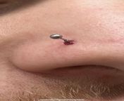 I fucked up. My nose ring got snagged on something and pulled through partially. from sneha nose ring pic