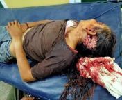 The situation in Rangoon, South Dagon Township, is not good at all. Min Aung Hlaing&#39;s terrorist groups are very cruel.They are firing machine guns and snipers. There are still casualties and the exact number is unknown. This is a picture of a 15-year- from www japan groups comayantara very sex saree