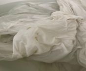 Dried blood stains linen sheets from linen