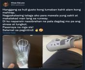 Vias shares an xray of her injury and how she felt at that time from kagal agarwel xray nude