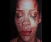 Just a reminder of what a POS Chris Brown is since it seems like people have forgotten in recent years from xxx chris brown xxx rihhana