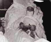 In 1961 Leonid Rogozov, the only doctor stationed at the Soviet Antarctic station, removed his own appendix by himself during an emergency operation from 1961 emergency childbirth
