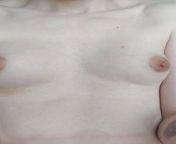 How do you like my budding new titties? (Over a year now on HRT) from budding