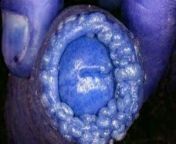 [50/50] (SFW) A delicious plate of blue waffles &#124; (NSFW) Penis infected with Blue Waffle disease (edited hue) from waffle chan