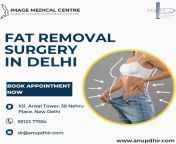 Fat Removal Surgery in Delhi- Dr. Anup Dhir from anup jalota