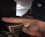 How does my foreskin look on my thick uncut cock? [32] from hindu uncut bully muslims wives sex com
