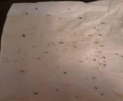 Coming out her skin after meth! What is it? My mom has been doing meth since September. I dont see her but we text sometimes and she is convinced these are bugs from ingesting a bug. She feels them but obviously its not real but what are these?! from janakapur meth