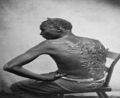 Runaway slave Gordon, exposing his severely whipped back. Gordon had received a severe whipping for undisclosed reasons in the fall of 1862. Gordon escaped in March 1863 from the 3,000 acre plantation of John &amp; Bridget Lyons, who held him and 40 other from femdom whipping for borrowed