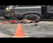 [50/50] A small upside down carrot (SFW) &#124; A man sliced in half in a road accident (NSFW) from indian small gril nude in gb road
