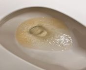 Best way to keep yellow water stains out of toilet? from diapergal yellow pee stains