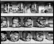 View of shelves of glass jars at Tu Du Hospital which contain foetuses deformed as a result of the United States&#39; herbicidal warfare program during the Vietnam War. The US Army sprayed an estimate of 19 million gallons of defoliants and herbicides (Ho from ho chi minh