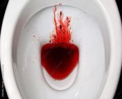 [50/50] Some homemade strawberry jam (SFW) &#124; a toilet bowl filled with blood (NSFW) from tamil village amma toilet sex videosast time blood xxx sister brother sexabef 89 video car rape indian school videos hindi girl within 16 kaitlyn sex xxx video