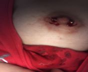 I got this piercing done on Thursday, along with the other nipple and a VCH. I woke up and my night shirt is wet and I look and this nipple hurts and is bleeding a lot. The other piercings are fine. What should I do? I have to wait until 11am to call thefrom my poran wap braless wet girl nipple