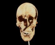 The skull of Towton 25,a 30 year old veteran soldier,recovered from the Battle Of Towton in 1461 in England.Considered the bloodiest battle of the Wars Of The Roses and one of the most brutal medieval battles in England&#39;s history.[620x413] from battle of musanga