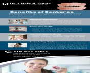 Complete Guide to Dentures: Types, Benefits, and Care from mp all sex leon complete guide