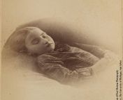 Post-mortem photo of a young girl, late 1800s from xxx dead body girl post mortem film com