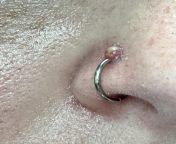 nose piercing bump from ayesha thai sexan lades nose piercing