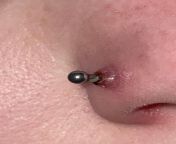 Red lump on nose piercing from niple piercing