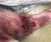 Growth removal on left hind leg. Owners declined cytology. Incision bled consistently two-three days post op and finally decided to bring him in. It looked about 10% as bad, we bandaged it and dr added staples. Went to recheck today... from www hind cax