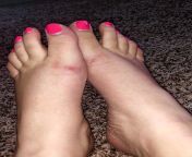 Sore feet from wearing flats all day (without socks ?) You can see the marks it left from digging into the top of my feet? comments &amp; DMs welcome! from ravina dandan feet