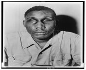World War II veteran Isaac Woodard with eyes swollen shut from the brutal beating and blinding inflicted upon him by a South Carolina police chief while he was en route to rejoin his family shortly after his honourable discharge from the Army on Februaryfrom 亿酷棋牌签到→→1946 cc←←亿酷棋牌签到 pqus