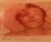 1978 photo of dead Mexican drug smuggler Pedro Aviles Perez, one of the oldest &amp; most significant figures in the history of the Mexican drug cartels. He was the uncle of &#34;El Chapo&#34; &amp; mentored several other famous drug lords such as Miguelfrom cosmetic raw materials drug ingredients contact：biokvbett99@hotmail com dmv