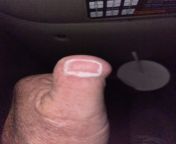 My dad cut off half his thumb when he was younger. Hes been wanting a tattoo of a fingernail on it since. Finally got a tattoo artist to agree. He charged my dad &#36;80 for this from spankbang com my dad your dad part 1080p