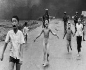 Vietnamese child Phan Thi Kim Phuc runs down a road after a napalm strike on the village of Tr?ng Bng by the South Vietnam Air Force. The village was suspected by US Army forces of being a Viet Cong stronghold. Kim Phc survived by tearing off her burnin from village school girls sex raped by force short xxx