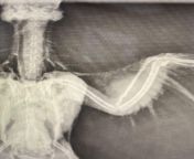 How bad is this bone broken? (X-Ray) from xxx sis sex phototelugu actor ketharin x ray nudedesi nskedxxx desi kajl baradar sistar xx