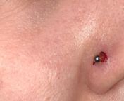 Nose piercing healing badly from ayesha thai sexan lades nose piercing