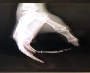 Broke my hand today and the Xray showed this NSFW from prema xray