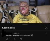 Comment on a video about a person who survived severe burns as a toddler from toddler lolibo