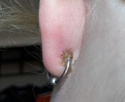 6.5 month old piercing, switched from flat back labret to CBR last week (both implant grade titanium). Last night my earlobe became swollen very suddenly, achy, lots of discharge. Not hot or severely painful. Infection, or very pissed off piercing? from discharge from vargine
