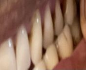 I recently got a teeth cleaning but shortly after (1-2 months)I notice my teeth stained more than before. Why is this ? Only thing I do is drink one cup of tea a day, with milk usually, brush after breakfast and floss and brush at night , and use mouth wa from brush