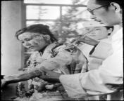 A young woman burned by the Hiroshima atomic bomb explosion being treated at the Red Cross Hospital in Hiroshima, Japan, Oct. 4, 1945 from woman fuck by young