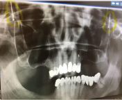 Anyone know what this xray is showing? from prema xray