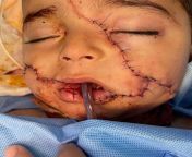 What the Israelis do with their US American and German bombs. Every day. UN: More children were killed in Gaza in six months than in the last four years of conflict worldwide. from aswariya roi xxxxxx