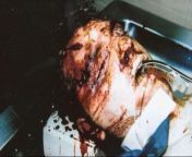 A post mortem photo of Jeffrey Dahmer after being beat to death by Christopher Scarver with a metal bar at the Columbia Correctional Institution in Portage, Wisconsin. from arabi all garl post mortem