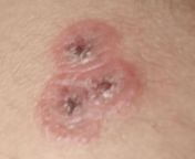 should i be worried for my knee wound(got it may 18 in pool with a rough floor) from sandra orlow nude in pool 2 jpg