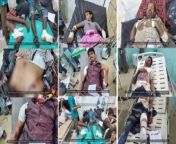 The life of citizens residing on the border areas with Saudi Arabia has become a nightmare, due to the Saudi artillery and missile bombardment that targets those areas on a daily basis, amid a deliberate and shameful disregard by the international organiz from saudi arabia xxx mms videos