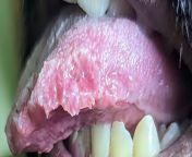 Problem with my tongue. from ahona rahman