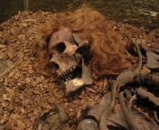 The &#34;Bocksten man&#34; bog body. The skeleton of a man who died around 700 years ago in Sweden, found with his full head of hair intact from the stepdaughter of remarried man