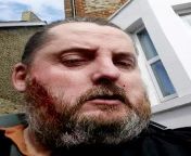Selfie taken in 2017 by Michael Danaher outside the home of Oxford book dealer Adrian Greenwood. Michael took the selfie after stabbing Adrian to death over a rare book, and Adrian&#39;s blood can be seen on his face. from adrian monk captions
