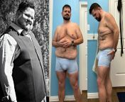 M/37/5&#39;9&#34;(175cm)[527 lbs &amp;gt; 216 lbs = 311 lbs (239 kg &amp;gt; 98 kg = 141 kg)](70 months *5 years 10 months) - First is from my wedding day 3/16. That was when I realised just how far I&#39;d gone. Diet, Exercise, Anti-Depressants, Therapy. from choti kg