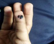 Do I need to get this checked out by a doctor? I hurt by hand 2 days ago while keeping a dumbbell and it bleeded for a while but now its black. Do I need to be worried? from sadha xxx photow xxx do