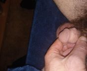 My tiny erect 1.5 inch micro penis. I have never been able to penitrate a women because its to small to make it past the opening. ? from gay micro penis