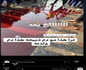[NSFW]........This is what is happening in Iraq and so peaceful demonstrations are suppressed. This is the blood of the demonstrators after the security forces suppressed them from iraq schools